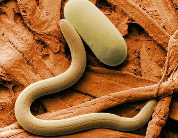 kaip atrodo nematodai